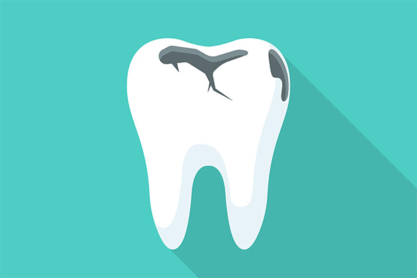 Can A Root Canal Treatment Reverse Tooth Decay?