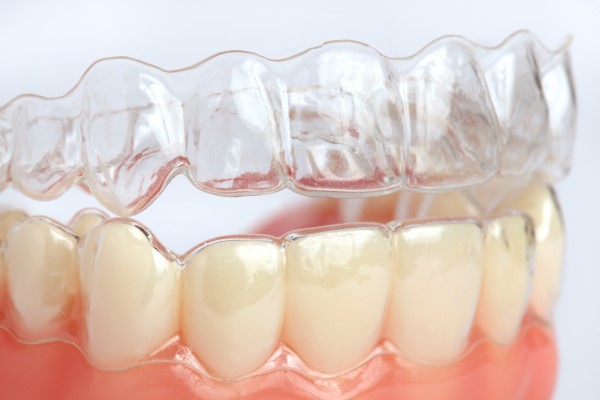 Ask a Dentist: Can ClearCorrect Invisible Braces Treat All Bite