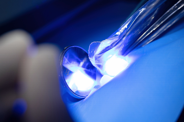 Dental Bonding Explained: How It Fixes Chips, Gaps &#   ; Stains