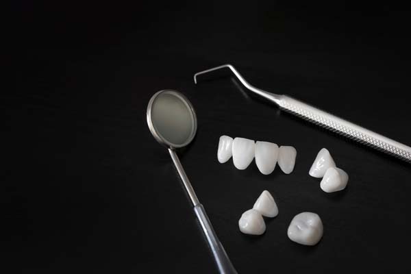 What Is A Dental Bridge?