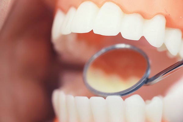 Why A Dental Check Up Is So Important