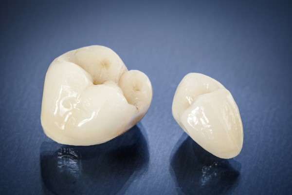 Questions To Ask Before Getting Dental Crowns