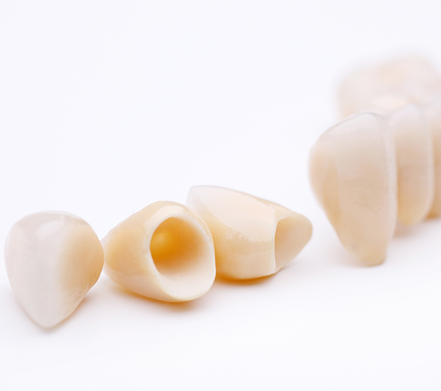 Turlock Dental Crowns and Dental Bridges