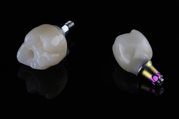 How Dental Implants Can Help Your Jawbone