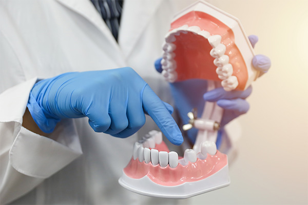Dentist Consult For Options For Replacing Missing Teeth