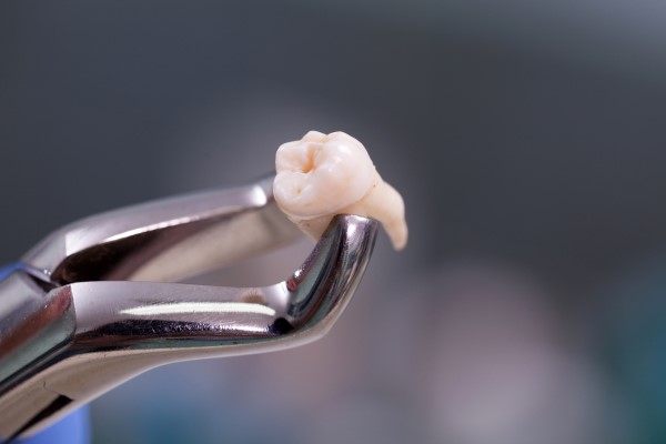 Is A Wisdom Tooth Extraction A Common Procedure?